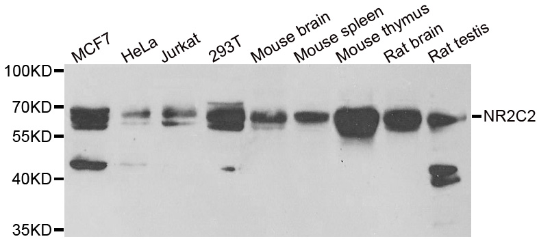 NR2C2 / TAK1 Antibody - Western blot analysis of extracts of various cell lines.