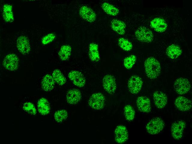 NR2C2 / TAK1 Antibody - Immunofluorescence staining of NR2C2 in A431 cells. Cells were fixed with 4% PFA, permeabilzed with 0.3% Triton X-100 in PBS, blocked with 10% serum, and incubated with rabbit anti-Human NR2C2 polyclonal antibody (dilution ratio 1:1000) at 4°C overnight. Then cells were stained with the Alexa Fluor 488-conjugated Goat Anti-rabbit IgG secondary antibody (green). Positive staining was localized to nucleus.