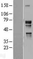 NR2C2 / TAK1 Protein - Western validation with an anti-DDK antibody * L: Control HEK293 lysate R: Over-expression lysate