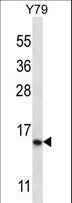 NR2C2AP / TRA16 Antibody - NR2C2AP Antibody western blot of Y79 cell line lysates (35 ug/lane). The NR2C2AP antibody detected the NR2C2AP protein (arrow).