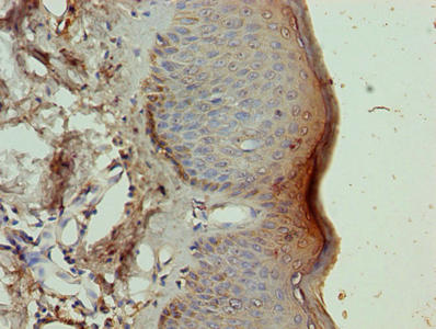 NR2C2AP / TRA16 Antibody - Immunohistochemistry of paraffin-embedded human skin tissue using NR2C2AP Antibody at dilution of 1:100