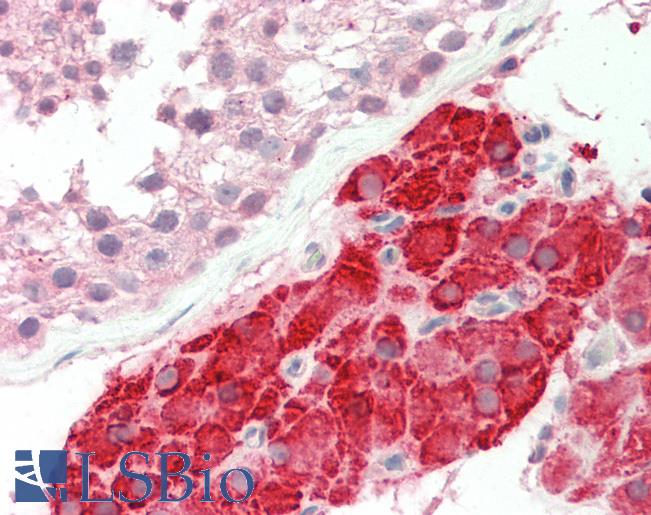 NR2E1 / TLX Antibody - Human Testis: Formalin-fixed, paraffin embedded (FFPE) tissue.  This image was taken for the unconjugated form of this product. Other forms have not been tested.