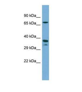 NR2E1 / TLX Antibody - Western blot of Human THP-1. NR2E1 antibody dilution 1.0 ug/ml.  This image was taken for the unconjugated form of this product. Other forms have not been tested.