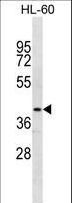 NR2E1 / TLX Antibody - NR2E1 Antibody western blot of HL-60 cell line lysates (35 ug/lane). The NR2E1 antibody detected the NR2E1 protein (arrow).