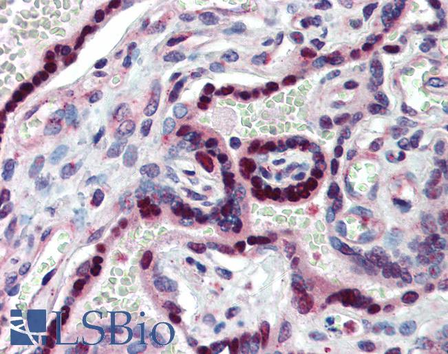NR2E1 / TLX Antibody - Anti-NR2E1 antibody IHC of human placenta. Immunohistochemistry of formalin-fixed, paraffin-embedded tissue after heat-induced antigen retrieval. Antibody concentration 5 ug/ml.  This image was taken for the unconjugated form of this product. Other forms have not been tested.
