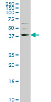 NR2E1 / TLX Antibody - NR2E1 monoclonal antibody (M01), clone 1C4 Western Blot analysis of NR2E1 expression in NIH/3T3.