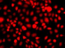 NR2E1 / TLX Antibody - Immunofluorescence analysis of A549 cells.