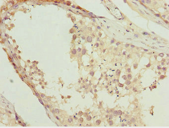 NR2E1 / TLX Antibody - Immunohistochemistry of paraffin-embedded human testis tissue at dilution 1:100