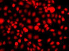 NR2E1 / TLX Antibody - Immunofluorescence analysis of A549 cells using NR2E1 antibody.