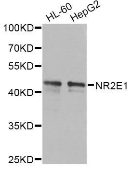 NR2E1 / TLX Antibody - Western blot analysis of extracts of various cell lines, using NR2E1 antibody at 1:1000 dilution. The secondary antibody used was an HRP Goat Anti-Rabbit IgG (H+L) at 1:10000 dilution. Lysates were loaded 25ug per lane and 3% nonfat dry milk in TBST was used for blocking. An ECL Kit was used for detection and the exposure time was 90s.