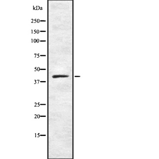 NR2E1 / TLX Antibody - Western blot analysis NR2E1 using HeLa whole cells lysates