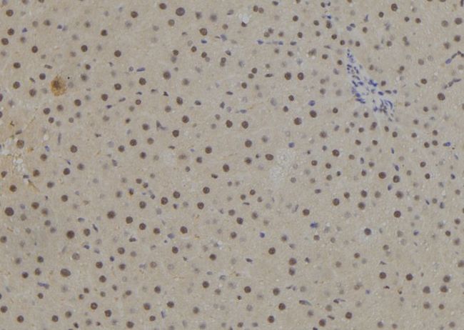 NR2E1 / TLX Antibody - 1:100 staining rat liver tissue by IHC-P. The sample was formaldehyde fixed and a heat mediated antigen retrieval step in citrate buffer was performed. The sample was then blocked and incubated with the antibody for 1.5 hours at 22°C. An HRP conjugated goat anti-rabbit antibody was used as the secondary.