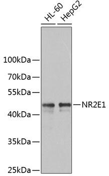 NR2E1 / TLX Antibody - Western blot analysis of extracts of various cell lines using NR2E1 Polyclonal Antibody at dilution of 1:1000.