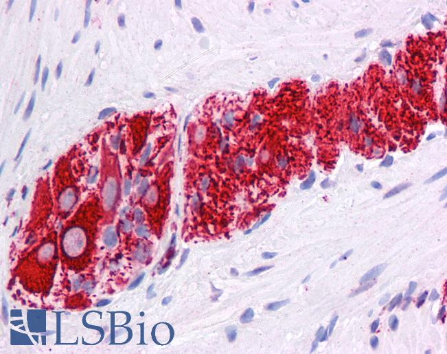 NR2E1 / TLX Antibody - Anti-NR2E1 antibody IHC of human colon, myenteric plexus. Immunohistochemistry of formalin-fixed, paraffin-embedded tissue after heat-induced antigen retrieval. Antibody concentration 5 ug/ml.  This image was taken for the unconjugated form of this product. Other forms have not been tested.