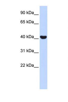 NR2E1 / TLX Antibody - NR2E1 antibody Western blot of Fetal Muscle lysate. Antibody concentration 1 ug/ml. This image was taken for the unconjugated form of this product. Other forms have not been tested.