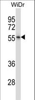 NR2E3 / PNR Antibody - NR2E3 Antibody western blot of WiDr cell line lysates (35 ug/lane). The NR2E3 antibody detected the NR2E3 protein (arrow).