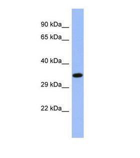 NR2E3 / PNR Antibody - Western blot of Human OVCAR-3. NR2E3 antibody dilution 1.0 ug/ml.  This image was taken for the unconjugated form of this product. Other forms have not been tested.