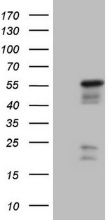 NR2E3 / PNR Antibody - HEK293T cells were transfected with the pCMV6-ENTRY control. (Left lane) or pCMV6-ENTRY NR2E3. (Right lane) cDNA for 48 hrs and lysed. Equivalent amounts of cell lysates. (5 ug per lane) were separated by SDS-PAGE and immunoblotted with anti-NR2E3.