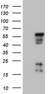 NR2E3 / PNR Antibody - HEK293T cells were transfected with the pCMV6-ENTRY control. (Left lane) or pCMV6-ENTRY NR2E3. (Right lane) cDNA for 48 hrs and lysed. Equivalent amounts of cell lysates. (5 ug per lane) were separated by SDS-PAGE and immunoblotted with anti-NR2E3.