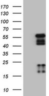 NR2E3 / PNR Antibody - HEK293T cells were transfected with the pCMV6-ENTRY control. (Left lane) or pCMV6-ENTRY NR2E3. (Right lane) cDNA for 48 hrs and lysed. Equivalent amounts of cell lysates. (5 ug per lane) were separated by SDS-PAGE and immunoblotted with anti-NR2E3.