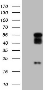 NR2E3 / PNR Antibody - HEK293T cells were transfected with the pCMV6-ENTRY control. (Left lane) or pCMV6-ENTRY NR2E3. (Right lane) cDNA for 48 hrs and lysed. Equivalent amounts of cell lysates. (5 ug per lane) were separated by SDS-PAGE and immunoblotted with anti-NR2E3.