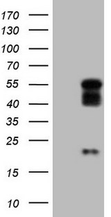 NR2E3 / PNR Antibody - HEK293T cells were transfected with the pCMV6-ENTRY control (Left lane) or pCMV6-ENTRY NR2E3 (Right lane) cDNA for 48 hrs and lysed. Equivalent amounts of cell lysates (5 ug per lane) were separated by SDS-PAGE and immunoblotted with anti-NR2E3.