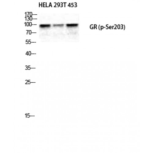 NR3C1/Glucocorticoid Receptor Antibody - Western blot of Phospho-GR (S203) antibody