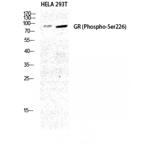 NR3C1/Glucocorticoid Receptor Antibody - Western blot of Phospho-GR (S226) antibody