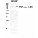 NR3C1/Glucocorticoid Receptor Antibody - Western blot of Phospho-GR (S226) antibody