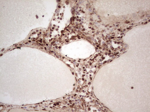 NR3C1/Glucocorticoid Receptor Antibody - IHC of paraffin-embedded Human lymph node tissue using anti-NR3C1 mouse monoclonal antibody. (Heat-induced epitope retrieval by 1 mM EDTA in 10mM Tris, pH8.5, 120°C for 3min).