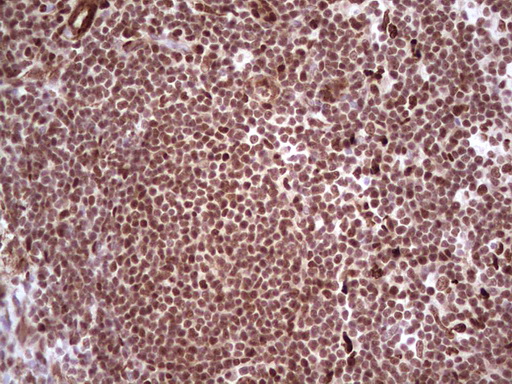 NR3C1/Glucocorticoid Receptor Antibody - IHC of paraffin-embedded Human tonsil using anti-NR3C1 mouse monoclonal antibody. (Heat-induced epitope retrieval by 1 mM EDTA in 10mM Tris, pH8.5, 120°C for 3min).