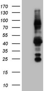 NR3C1/Glucocorticoid Receptor Antibody - Human recombinant protein fragment corresponding to amino acids 1-265 of human NR3C1(NP_000167) produced in E.coli. .
