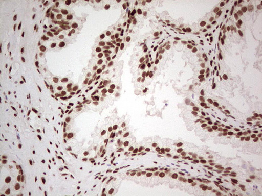NR3C1/Glucocorticoid Receptor Antibody - Immunohistochemical staining of paraffin-embedded Human prostate tissue within the normal limits using anti-NR3C1 mouse monoclonal antibody. (Heat-induced epitope retrieval by 1 mM EDTA in 10mM Tris, pH8.5, 120C for 3min,