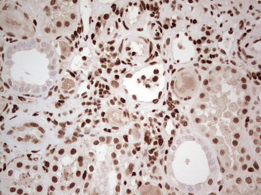NR3C1/Glucocorticoid Receptor Antibody - Immunohistochemical staining of paraffin-embedded Human Kidney tissue within the normal limits using anti-NR3C1 mouse monoclonal antibody. (Heat-induced epitope retrieval by 1 mM EDTA in 10mM Tris, pH8.5, 120C for 3min,