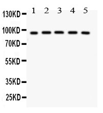 NR3C1/Glucocorticoid Receptor Antibody - NR3C1 antibody Western blot. All lanes: Anti NR3C1 at 0.5 ug/ml. Lane 1: HELA Whole Cell Lysate at 40 ug. Lane 2: MCF-7 Whole Cell Lysate at 40 ug. Lane 3: COLO320 Whole Cell Lysate at 40 ug. Lane 4: MM231 Whole Cell Lysate at 40 ug. Lane 5: HEPG2 Whole Cell Lysate at 40 ug. Predicted band size: 90 kD. Observed band size: 90 kD.