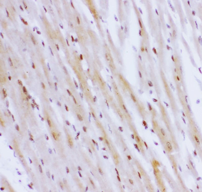 NR3C1/Glucocorticoid Receptor Antibody - NR3C1 antibody IHC-paraffin: Rat Cardiac Muscle Tissue.