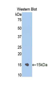 NR3C1/Glucocorticoid Receptor Antibody - Western blot of recombinant NR3C1/Glucocorticoid Receptor.  This image was taken for the unconjugated form of this product. Other forms have not been tested.