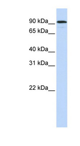 NR3C1/Glucocorticoid Receptor Antibody - NR3C1 / Glucocorticoid Receptor antibody Western blot of HeLa lysate. This image was taken for the unconjugated form of this product. Other forms have not been tested.