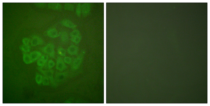 NR3C1/Glucocorticoid Receptor Antibody - Immunofluorescence analysis of A549 cells, using GR Antibody. The picture on the right is blocked with the synthesized peptide.