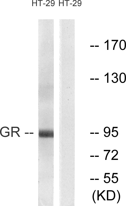 NR3C1/Glucocorticoid Receptor Antibody - Western blot analysis of lysates from HT-29 cells, treated with PMA 125ng/ml 30', using GR Antibody. The lane on the right is blocked with the synthesized peptide.