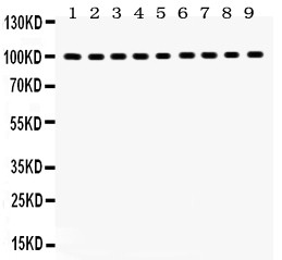 NR3C1/Glucocorticoid Receptor Antibody - NR3C1 antibody Western blot. All lanes: Anti NR3C1 at 0.5 ug/ml. Lane 1: Rat Liver Tissue Lysate at 50 ug. Lane 2: Rat Brain Tissue Lysate at 50 ug. Lane 3: Rat Spleen Tissue Lysate at 50 ug. Lane 4: Human Placenta Tissue Lysate at 50 ug. Lane 5: SMMC Whole Cell Lysate at 40 ug. Lane 6: HEPA Whole Cell Lysate at 40 ug. Lane 7: NEURO Whole Cell Lysate at 40 ug. Lane 8: HELA Whole Cell Lysate at 40 ug. Lane 9: PC-12 Whole Cell Lysate at 40 ug. Predicted band size: 86 kD. Observed band size: 100 kD.