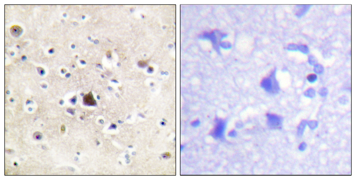 NR3C1/Glucocorticoid Receptor Antibody - Immunohistochemistry analysis of paraffin-embedded human brain tissue, using GR Antibody. The picture on the right is blocked with the synthesized peptide.