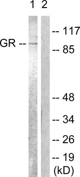 NR3C1/Glucocorticoid Receptor Antibody - Western blot analysis of lysates from Jurkat cells, treated with EGF 200ng/ml 15', using GR Antibody. The lane on the right is blocked with the synthesized peptide.
