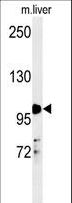 NR3C1/Glucocorticoid Receptor Antibody - NR3C1 Antibody western blot of mouse liver tissue lysates (35 ug/lane). The NR3C1 antibody detected NR3C1 protein (arrow).