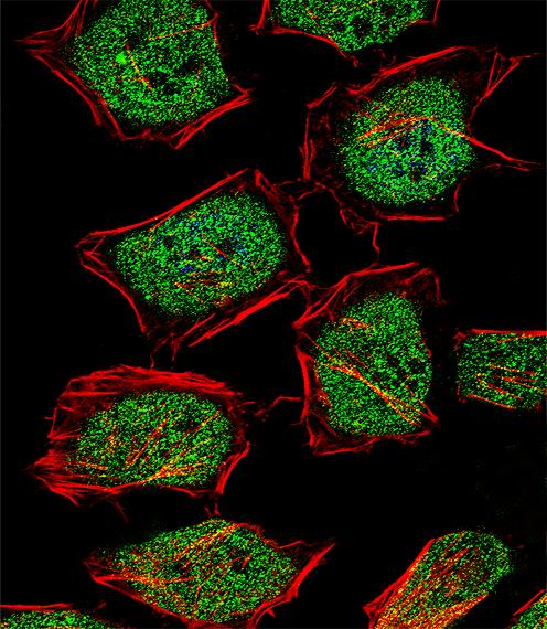 NR3C1/Glucocorticoid Receptor Antibody - Fluorescent confocal image of HeLa cell stained with NR3C1 Antibody. HeLa cells were fixed with 4% PFA (20 min), permeabilized with Triton X-100 (0.1%, 10 min), then incubated with NR3C1 primary antibody (1:25, 1 h at 37°C). For secondary antibody, Alexa Fluor 488 conjugated donkey anti-rabbit antibody (green) was used (1:400, 50 min at 37°C). Cytoplasmic actin was counterstained with Alexa Fluor 555 (red) conjugated Phalloidin (7units/ml, 1 h at 37°C). Nuclei were counterstained with DAPI (blue) (10 ug/ml, 10 min). NR3C1 immunoreactivity is localized to Cytoplasm and Nucleus significantly.