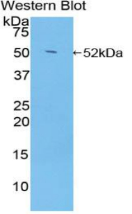 NR3C1/Glucocorticoid Receptor Antibody - Western blot of NR3C1/Glucocorticoid Receptor antibody.
