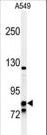 NR3C1/Glucocorticoid Receptor Antibody - Western blot of NR3C1 Antibody in A549 cell line lysates (35 ug/lane). NR3C1 (arrow) was detected using the purified antibody.