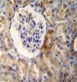 NR3C1/Glucocorticoid Receptor Antibody - NR3C1 Antibody immunohistochemistry of formalin-fixed and paraffin-embedded human kidney tissue followed by peroxidase-conjugated secondary antibody and DAB staining.