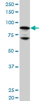 NR3C1/Glucocorticoid Receptor Antibody - NR3C1 monoclonal antibody (M01), clone 2C8. Western Blot analysis of NR3C1 expression in HeLa.