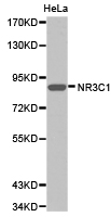 NR3C1/Glucocorticoid Receptor Antibody - Western blot of extracts of HeLa cell lines, using NR3C1 antibody.